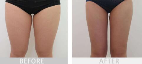 福州五位整形醫(yī)生名單首發(fā)，王彪、王美水等幫你塑造完美五官！