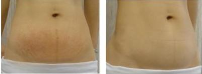 2023上饒手術(shù)祛抬頭紋專家在榜清單前10(李弦、張燦、周影優(yōu)勢詳解)