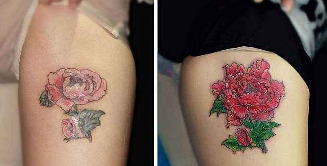 杭州填淚溝哪家醫(yī)院好？專家推薦的最佳醫(yī)療機(jī)構(gòu)