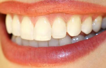 2023南通剝離填充痘印排行前十強(qiáng)的醫(yī)生(任欽平、浦若英、楊翔航口碑好收費(fèi)不坑)