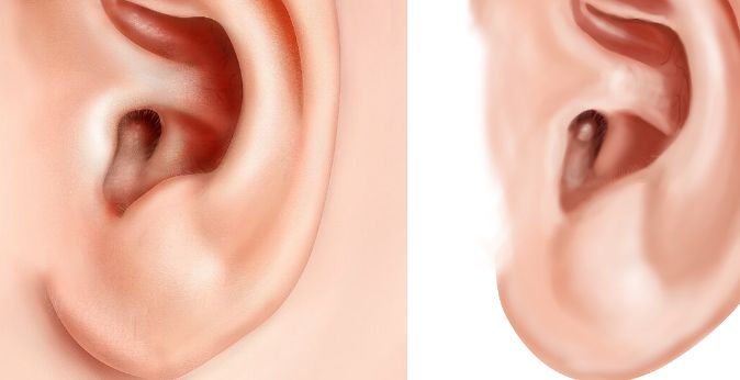 無錫看鼻子哪家醫(yī)院好？綜合評測揭秘?zé)o錫市專業(yè)鼻科醫(yī)院推薦