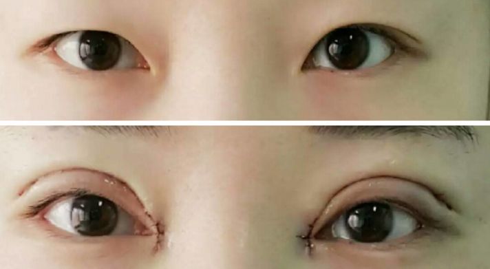 貴陽哪家醫(yī)院熱瑪吉效果好，值得推薦？