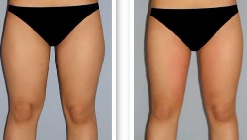 杭州疤痕醫(yī)院排名哪家好？揭秘杭州頂級(jí)疤痕醫(yī)院榜單！