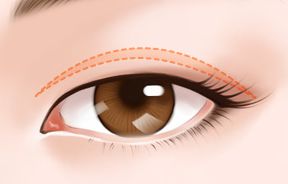 上海激光祛痣哪家醫(yī)院效果最好？