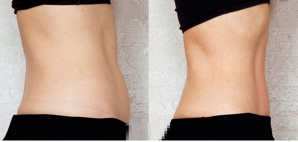 上海祛斑術(shù)哪家醫(yī)院好？解讀上海祛斑術(shù)醫(yī)院排名和專家推薦