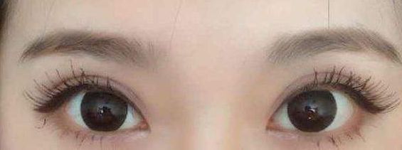 西安哪家醫(yī)院的激光祛痘項(xiàng)目質(zhì)量好？