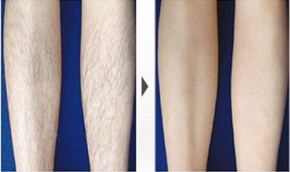 哈爾濱哪家醫(yī)院祛斑好？-排名第一的專業(yè)醫(yī)院，讓您擁有無瑕疵肌膚！