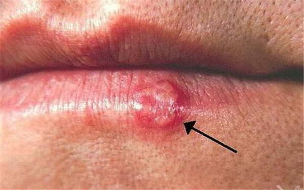 2023婁底熱瑪吉祛額頭紋排名前十醫(yī)生(邱敏、潘葵、蔣松林預(yù)約掛號(hào)攻略)