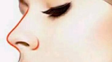 廣州安美國際林立荃醫(yī)生的個人簡歷和令人驚嘆的除皺抗衰案例分享