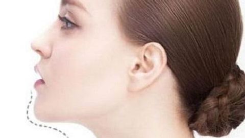 蘇州薇琳醫(yī)療美容醫(yī)院手術(shù)價格貴嗎？醫(yī)院如何介紹？