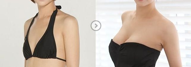 鄭州瘦臉針效果如何？一起探討哪家醫(yī)院好！