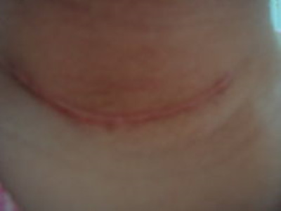 2023徐州玻尿酸注射法令紋醫(yī)生前10強(qiáng)口碑榜(俞曉江、程洋、劉迎迎靠譜醫(yī)院，安心選！)