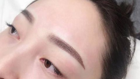 田國靜的眼袋修復(fù)價(jià)格如何？有推薦的醫(yī)生嗎？