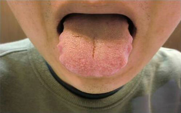 2023西寧下頜角修復(fù)正規(guī)專家口碑十強(韓玲、吳漢強、焦志云鎖定榜前三！)