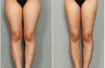 南寧皮膚外科醫(yī)院排名哪家醫(yī)院皮膚外科好？