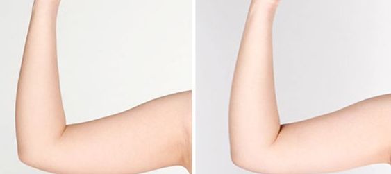 宿州雙眼皮醫(yī)院哪家好？揭秘宿州地區(qū)專業(yè)雙眼皮整形醫(yī)院