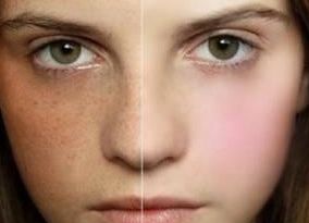 宿州疤痕修復(fù)醫(yī)院哪家好？幫你選擇最適合的宿州疤痕治療?？漆t(yī)院