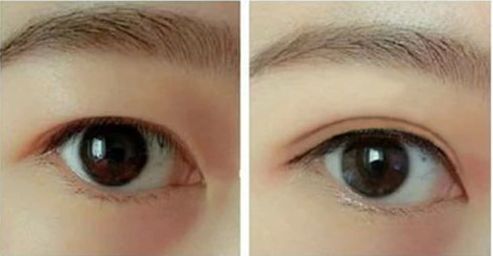 合肥熱瑪吉哪家醫(yī)院好？?jī)?yōu)質(zhì)服務(wù)與專業(yè)技術(shù)讓您擁有完美體驗(yàn)。