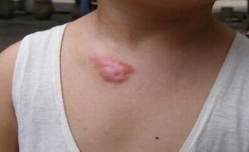 鄭州做鼻子修復哪家好？權威排名榜單解析！