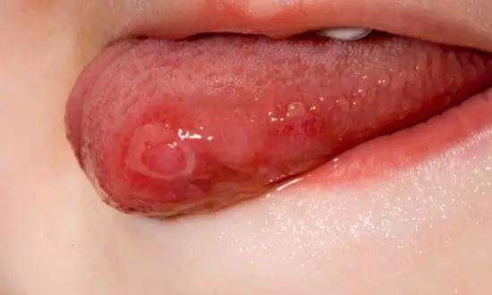 2023大連耳輪缺損修復(fù)排名前10強(qiáng)的專家(張曉桐、畢佳、劉曉辭符合大家審美需求)