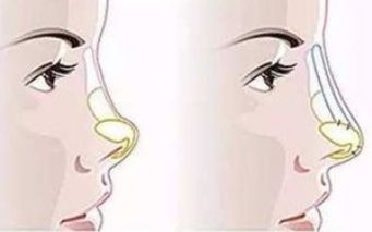 河南中醫(yī)藥大學(xué)第一附屬醫(yī)院整形科技術(shù)與醫(yī)生表現(xiàn)口碑如何？