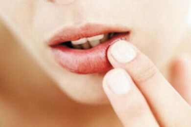 2023濟(jì)南激光祛眼睛細(xì)紋醫(yī)生前10強(qiáng)排名榜(李文德、王曉林、趙峰值得信賴和選擇！)