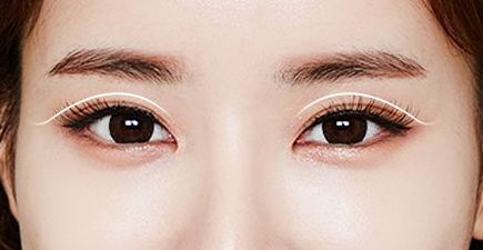 廣州專業(yè)豐胸醫(yī)院排行榜：哪家醫(yī)院正規(guī)靠譜又好？