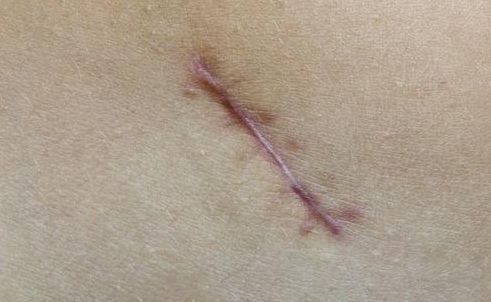 重慶整形技術，哪家醫(yī)院好？探尋重慶整形技術最佳醫(yī)院有哪些