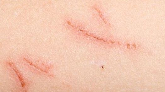 開封哪家醫(yī)院的減肥治療效果最好？