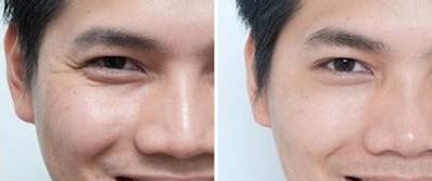 南京哪家整形醫(yī)院隆鼻效果最好？