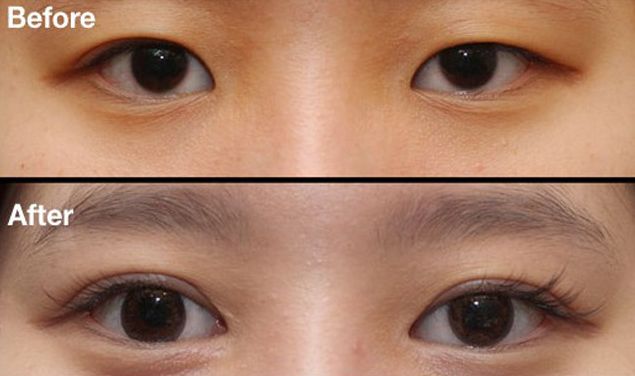 昆明刀疤修復(fù)哪家醫(yī)院好？挑選昆明專業(yè)刀疤修復(fù)醫(yī)院的技巧與要點