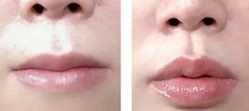 2023成都超高頻激光去雀斑權(quán)威專家評分前10強(肖凌、蒙坤容、李蕓去的人多且價格優(yōu)惠)