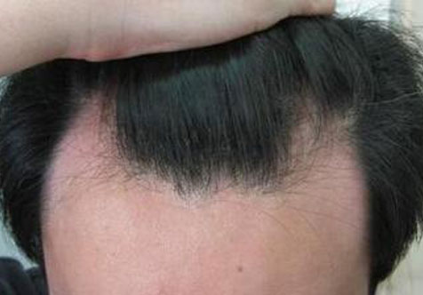 廣州曙光醫(yī)學(xué)美容醫(yī)院周展超潔膚法體驗(yàn)分享