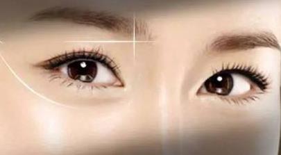 2023西寧針雕祛老年斑排名前10醫(yī)生(王曉霞、趙秀玲、鄭國榮人氣超高，建議收藏)