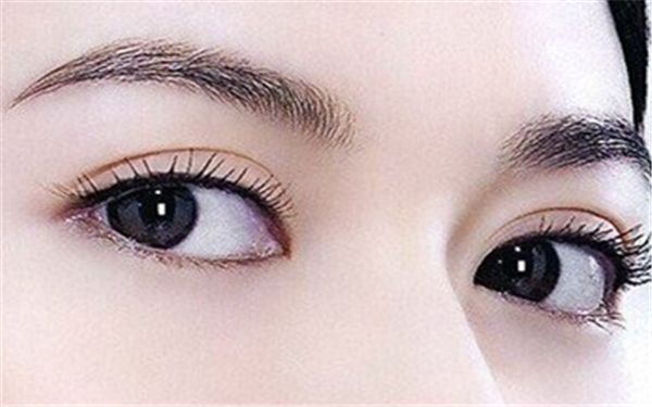 如何選擇北京雙眼皮埋線哪家好？細(xì)致評(píng)級(jí)幫您快速?zèng)Q策！