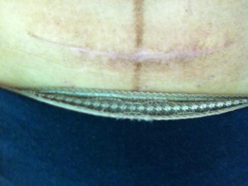 2023杭州注射物隆鼻正規(guī)專家排名榜10強(杜鵑、李彥鵬、王文佳網(wǎng)友力薦信息分享)