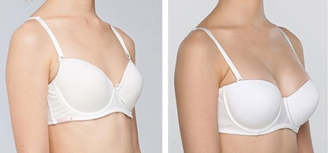 2023大連SVF自體脂肪移植口碑排行前10醫(yī)生(劉延偉、趙鳳霞、趙穆欣市民評價好正規(guī)不坑)