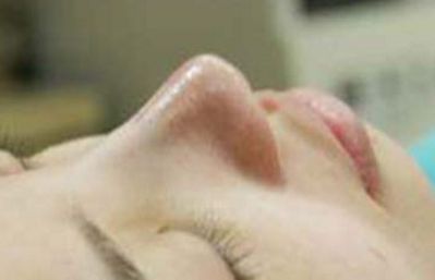 南京抽脂瘦身哪家醫(yī)院好？選對(duì)醫(yī)院是明智之舉！