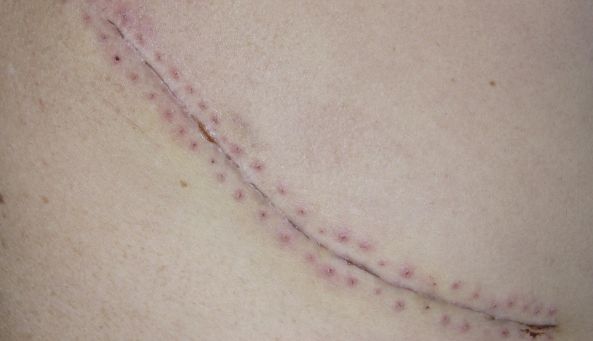 杭州整形醫(yī)院哪家服務(wù)好？選擇杭州整形醫(yī)院前需了解的幾點關(guān)鍵因素