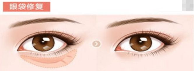 上海自體豐面部醫(yī)院排名榜單及評價對比[詳細分析]