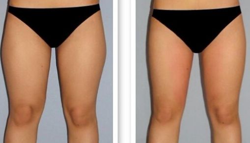 長(zhǎng)沙哪家激光點(diǎn)痣醫(yī)院口碑好？