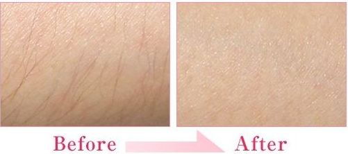 廣東珠?？泼泪t(yī)療美容醫(yī)院怎么樣？廣東珠海科美醫(yī)療美容醫(yī)院簡(jiǎn)介|醫(yī)生團(tuán)隊(duì)|口碑評(píng)價(jià)！