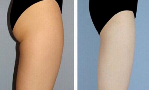 上海改臉型整形哪家醫(yī)院好？專家推薦悅美人整形醫(yī)院！