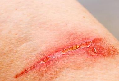 重慶去眼袋醫(yī)院哪家好？專業(yè)醫(yī)生推薦最佳醫(yī)院解決眼袋問(wèn)題