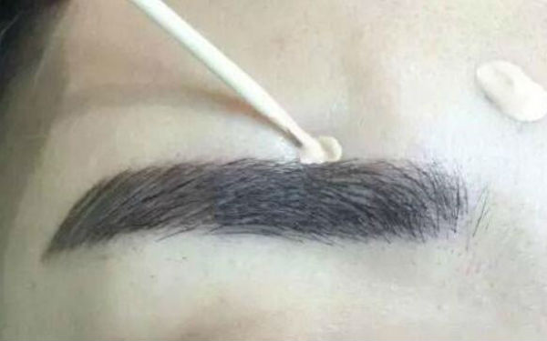 徐威強(qiáng)顎下角整形術(shù)：讓您輕松擁有自然平滑線條