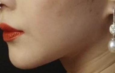 2023南寧1+N多效雙眼皮專家排行榜前10名(王昌松、徐贊正、朱格非口碑、實(shí)力一一盤點(diǎn))