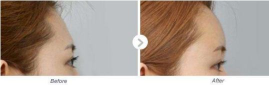 河南有哪家專業(yè)的小腿抽脂醫(yī)院值得推薦？