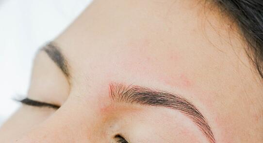 北京喬雅登名醫(yī)挖掘，新榜單首揭誰更強(qiáng)？技術(shù)絕優(yōu)對決揭曉！