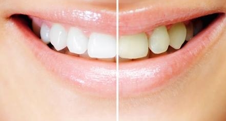 南方醫(yī)院董自清做面部脂肪填充效果如何？樸素自然且光滑無痕，沒有坑洼效應(yīng)嗎？