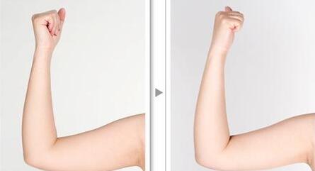 北醫(yī)三院謝詳主刀點(diǎn)評(píng)：五星植發(fā)案例驚艷登場(chǎng)